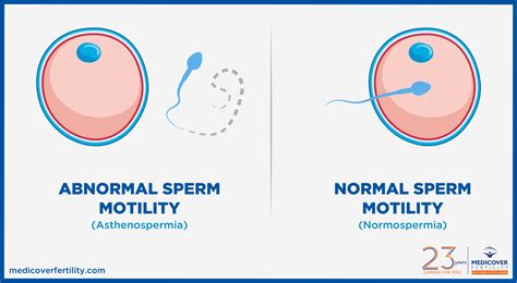 sperm motility range chart|Sperm motility: normal and low motility explained .